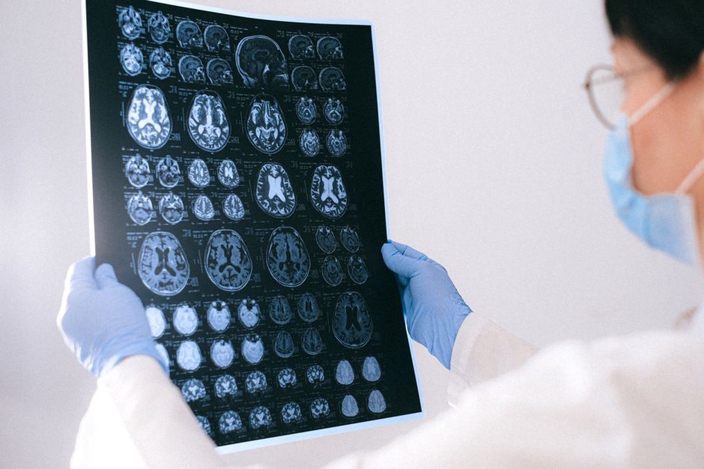 Brain scan slices displayed for clinical review