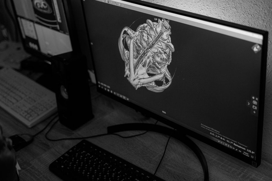 Marked regions on a grayscale medical scan