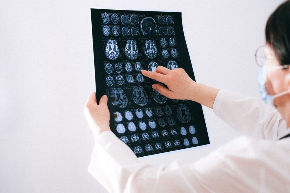 Outlined brain regions on an MRI study