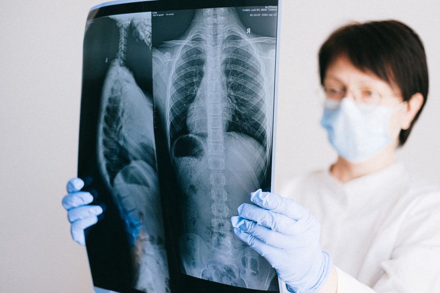 Cross-sectional lung image displayed for review