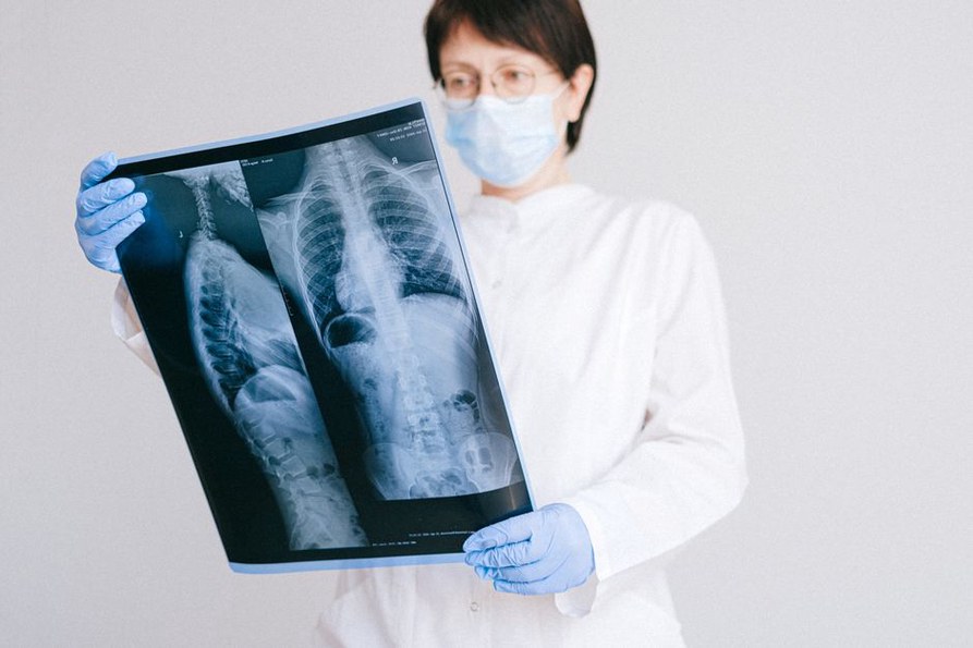 Chest CT slices displayed for clinical review